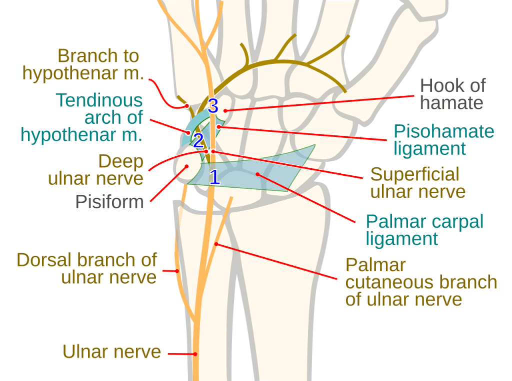Zespół kanału Guyona